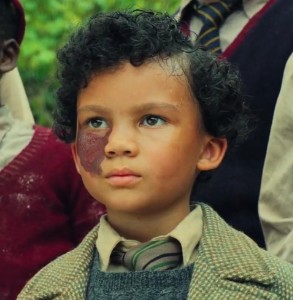 Boy with Birthmark (Lake Coleman-2026)