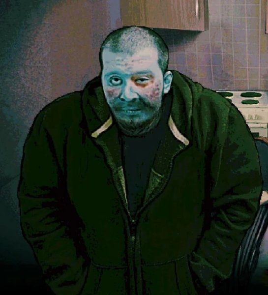 leper guy