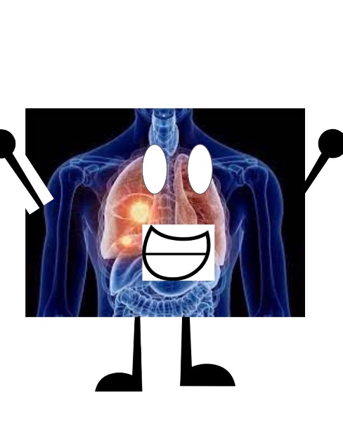 Lung Cancer Diagramy