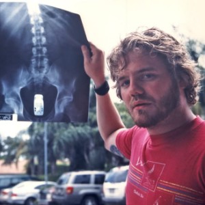 Ryan Dunn
