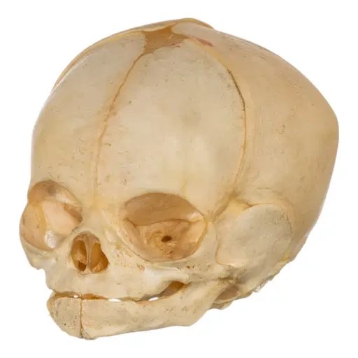 Skellybones 2