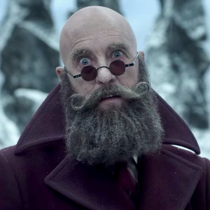 Man with no beard but hair