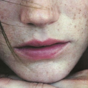 Clove