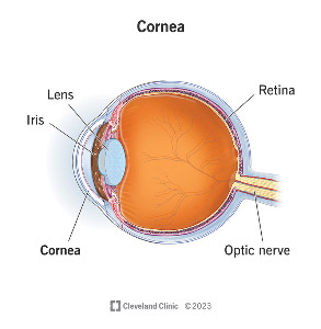 Cornea $57,000