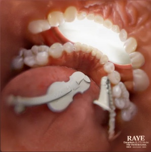 Escapism. - RAYE, 070 Shake