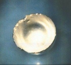 Fermium (₁₀₀Fm)