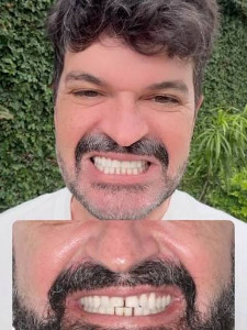 magal